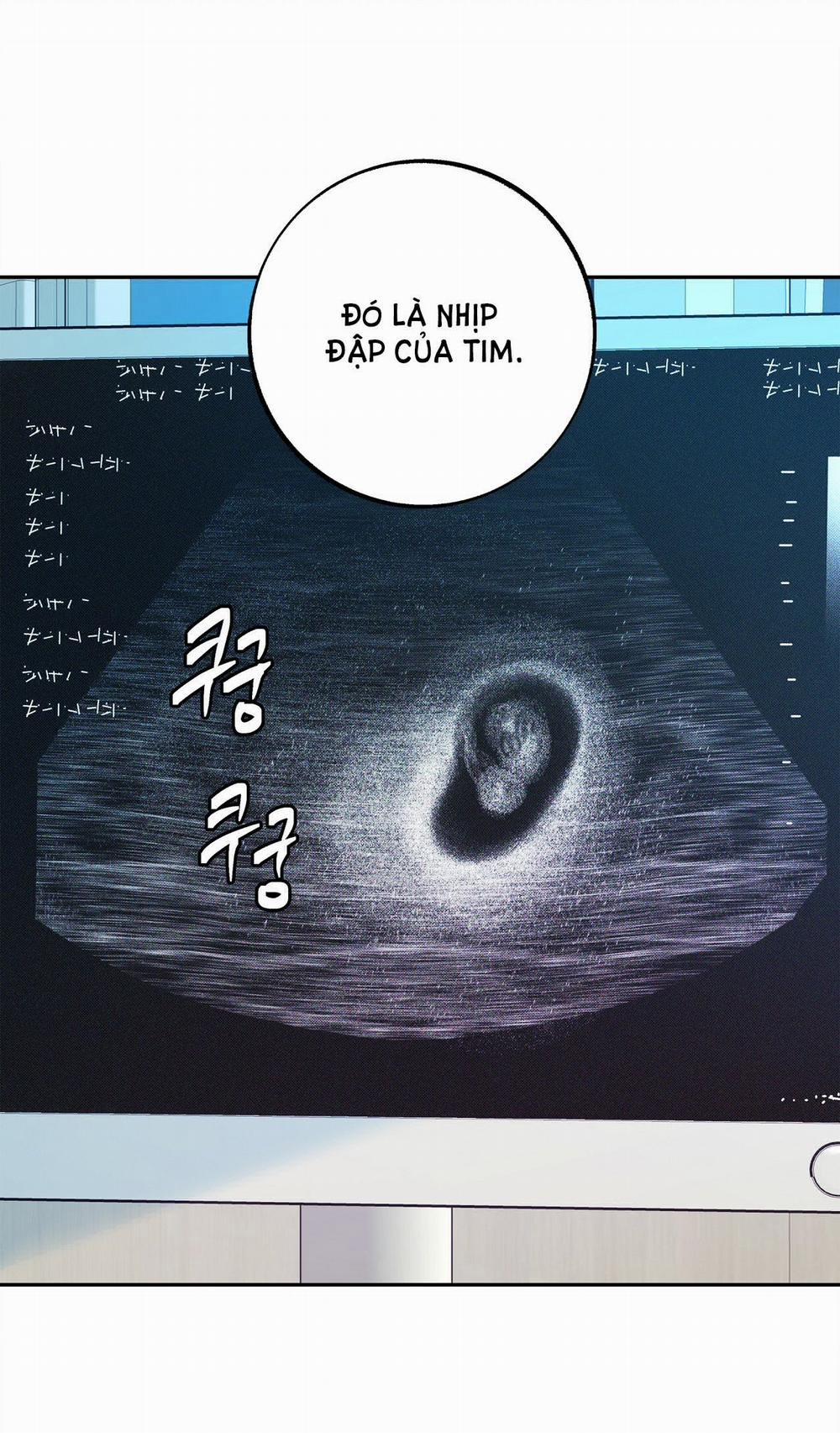 [18+] Tận Cùng Của Thế Giới 34.1 trang 31