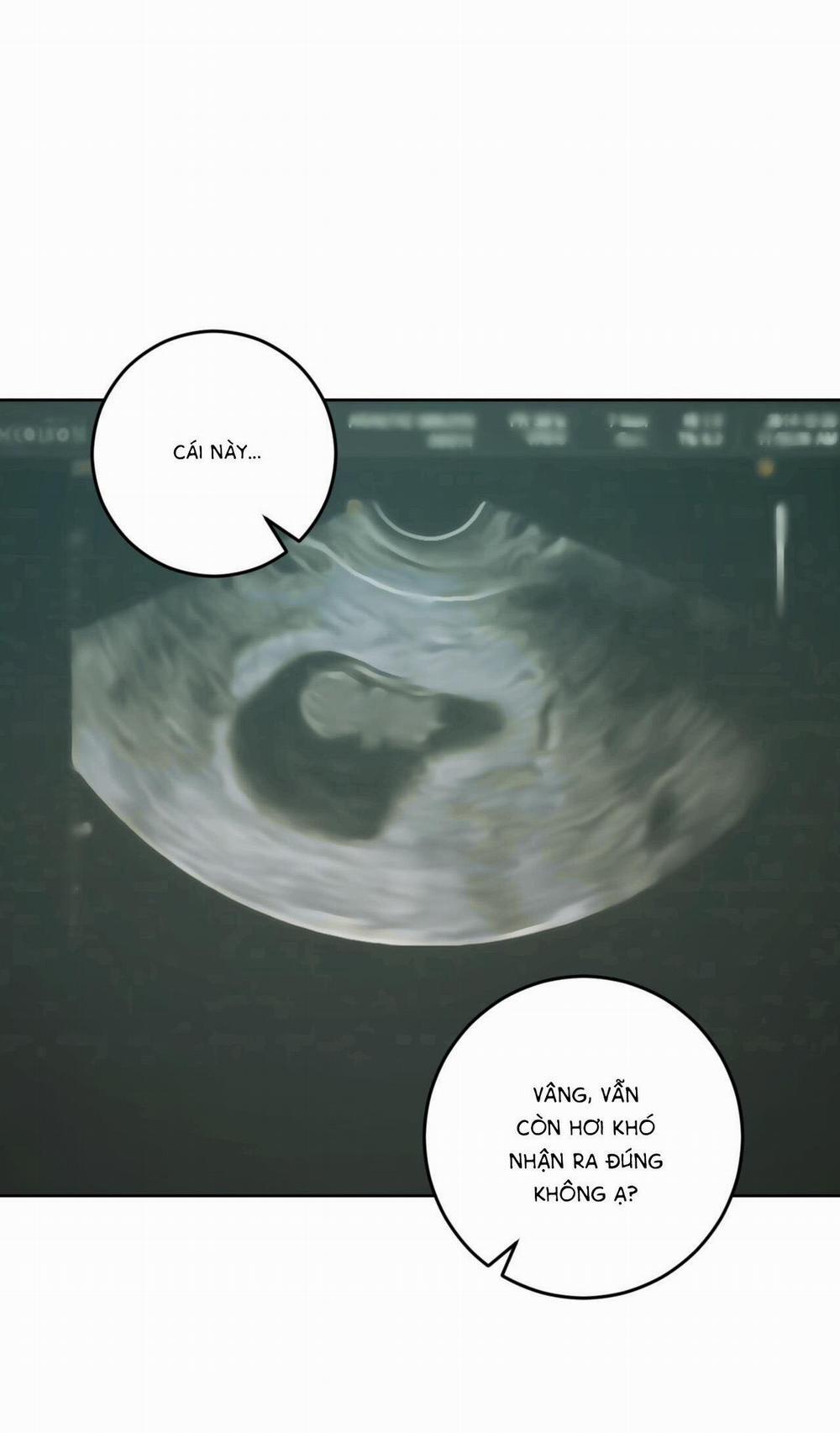 (Cbunu) Khu Rừng Tĩnh Lặng 34 trang 18
