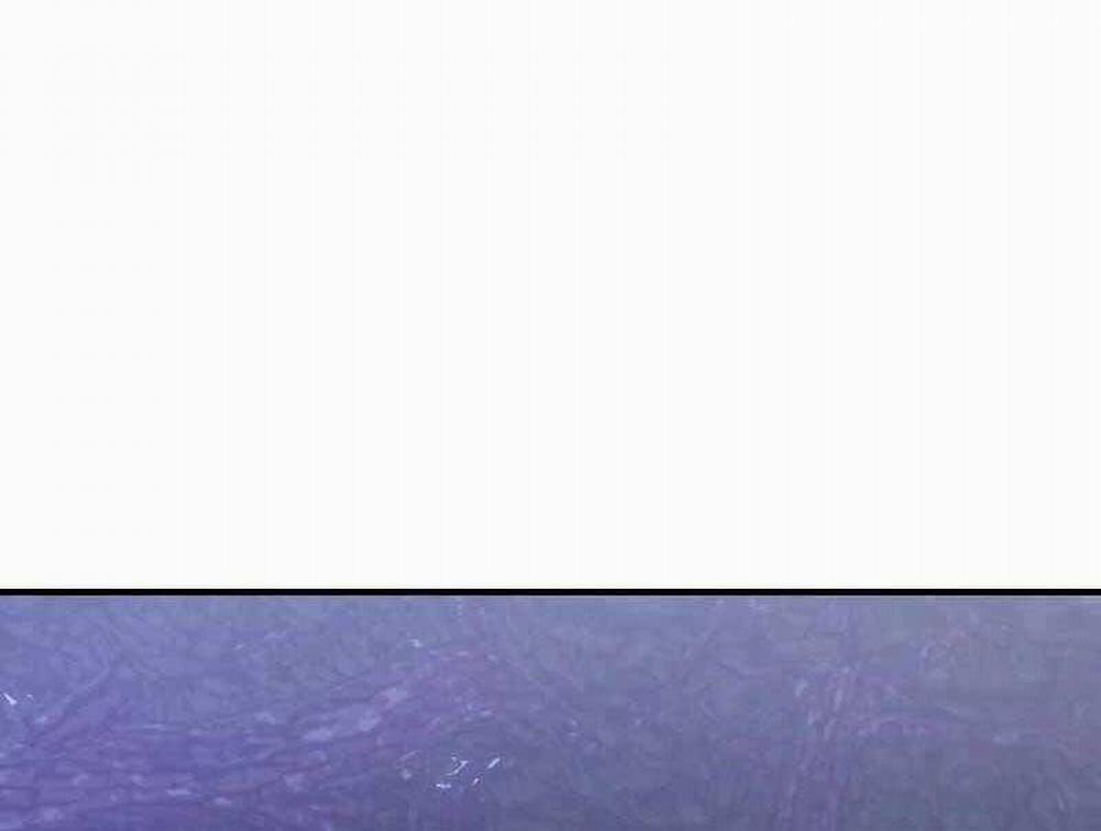 Hắc Kị Sĩ Thiên Tài Giới Hạn Thời Gian 11 trang 111