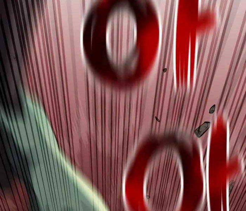 Hắc Kị Sĩ Thiên Tài Giới Hạn Thời Gian 23 trang 32