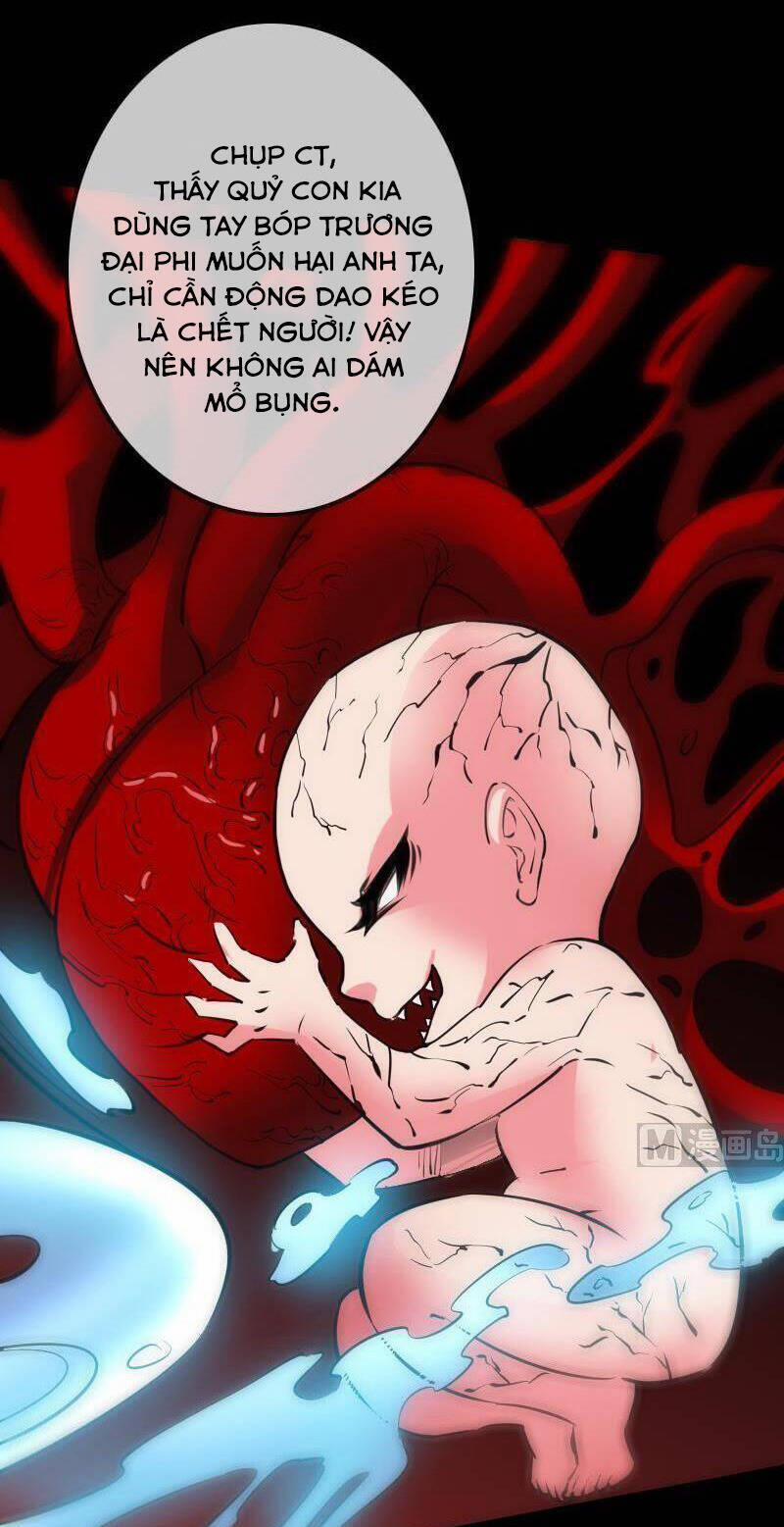 Kiếp Thiên Vận 121 trang 9