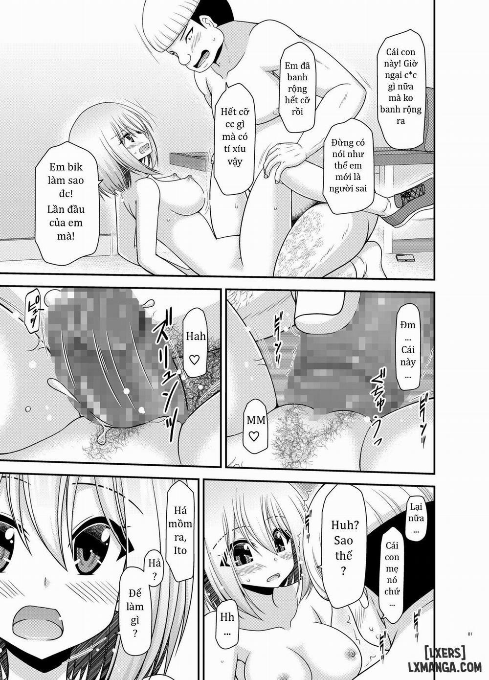 Nozokare Roshutsu Shoujo 2 trang 80