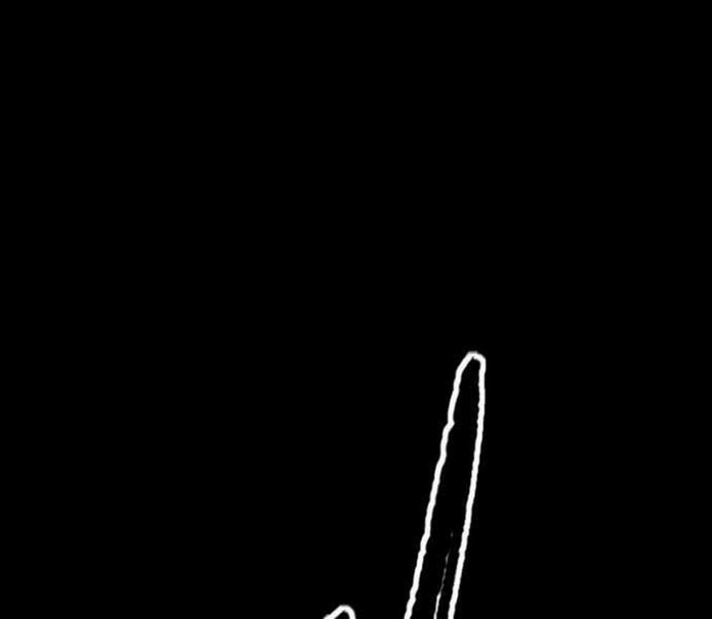 Thể Thao Cực Hạn 489.5 trang 91